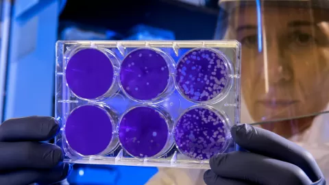Semana Mundial de Concientización sobre el Uso de los Antimicrobianos 2025: Un Llamado Urgente a la Acción Global para Proteger Nuestra Salud y Futuro